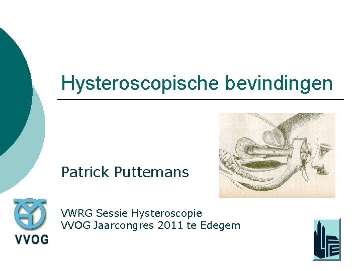 Hysteroscopische bevindingen Patrick Puttemans VWRG Sessie Hysteroscopie VVOG Jaarcongres 2011 te Edegem 