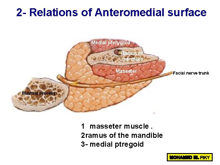 2 - Relations of Anteromedial surface Medial pterygoid Ramus of mandible Masseter Mastoid process