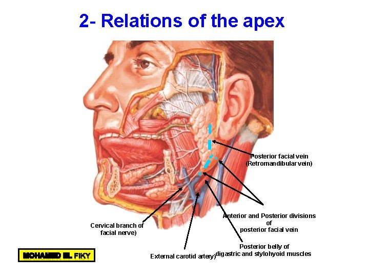 2 - Relations of the apex Posterior facial vein (Retromandibular vein) Cervical branch of