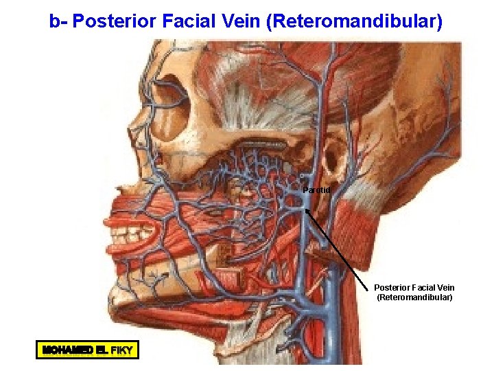 b- Posterior Facial Vein (Reteromandibular) Parotid Posterior Facial Vein (Reteromandibular) 