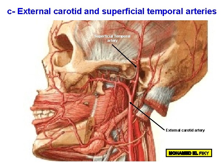 c- External carotid and superficial temporal arteries Superficial Temporal artery External carotid artery 