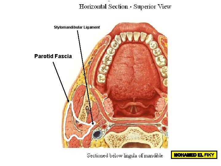 Stylomandibular Ligament Parotid Fascia 