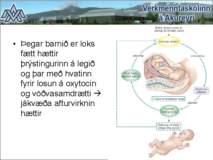  • Þegar barnið er loks fætt hættir þrýstingurinn á legið og þar með