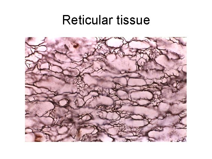 Reticular tissue 