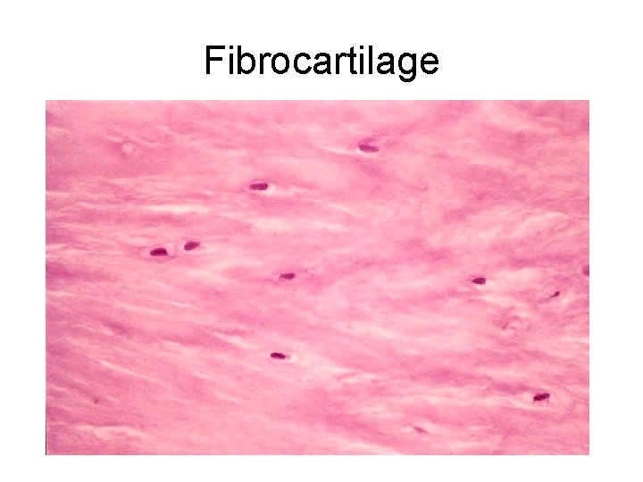 Fibrocartilage 