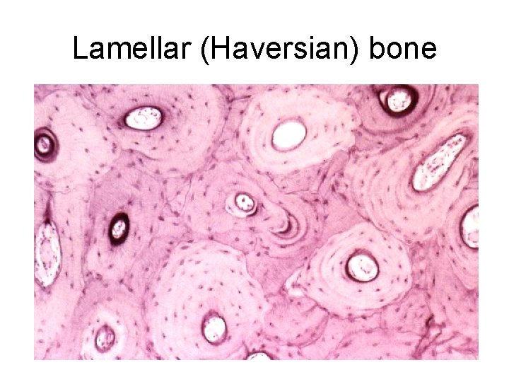 Lamellar (Haversian) bone 