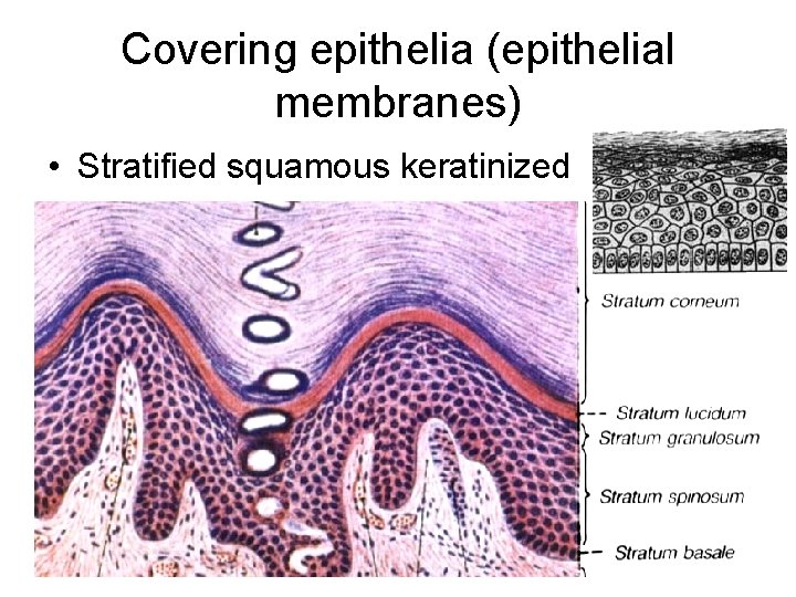 Covering epithelia (epithelial membranes) • Stratified squamous keratinized 