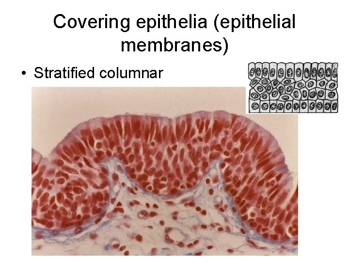Covering epithelia (epithelial membranes) • Stratified columnar 