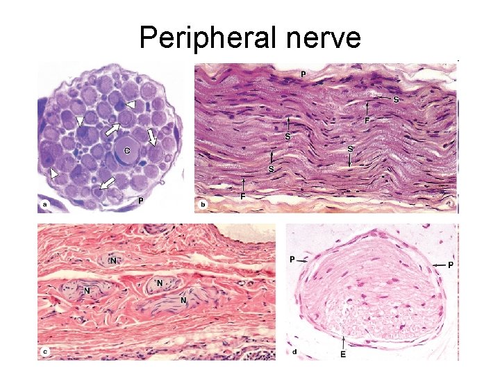 Peripheral nerve 