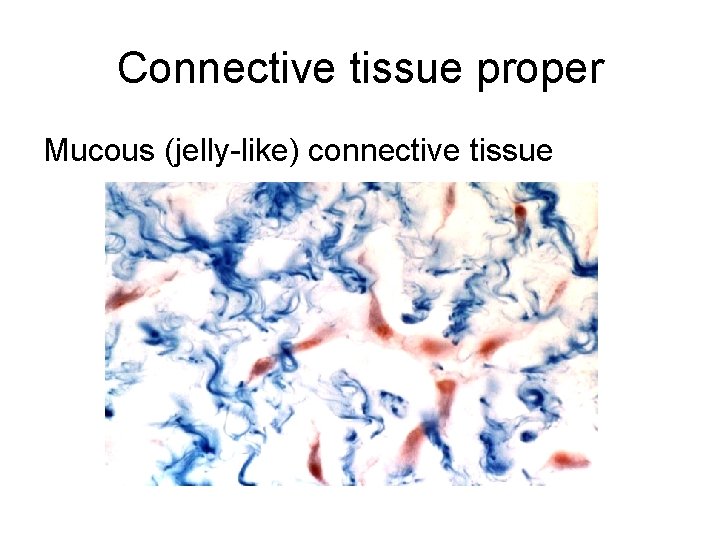 Connective tissue proper Mucous (jelly-like) connective tissue 