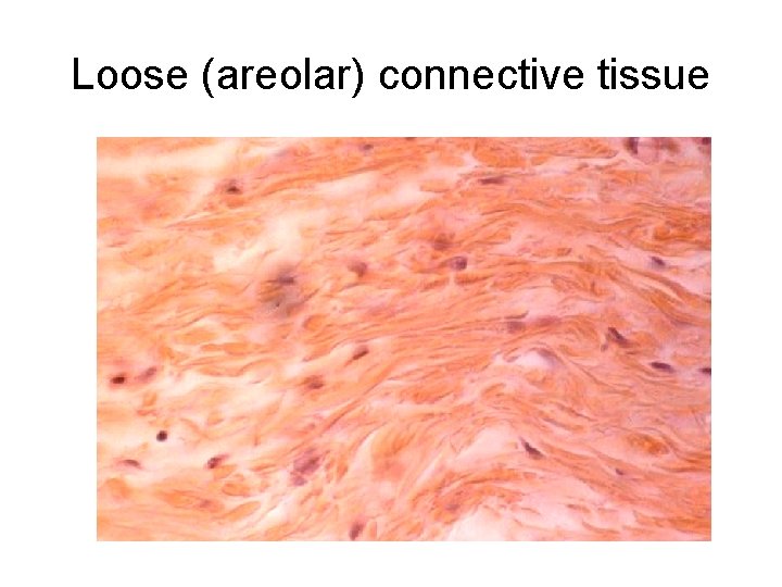 Loose (areolar) connective tissue 