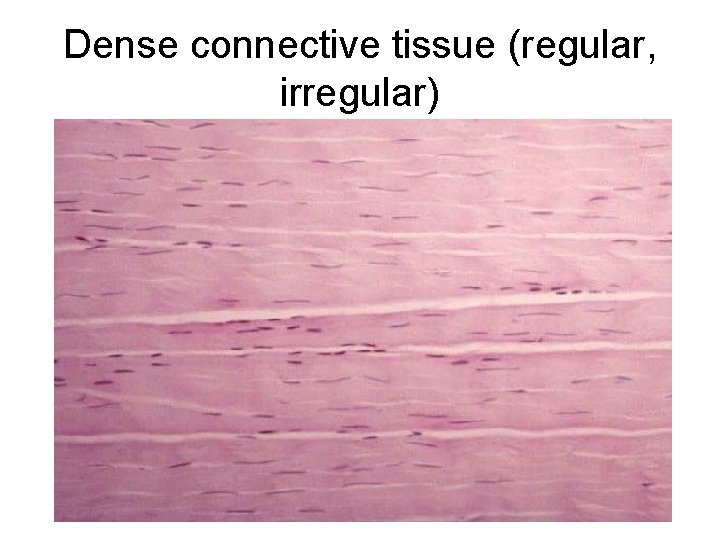 Dense connective tissue (regular, irregular) 