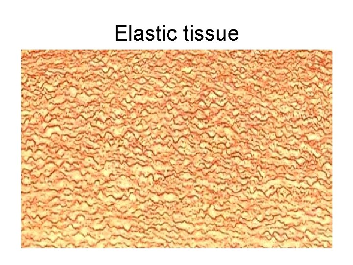 Elastic tissue 