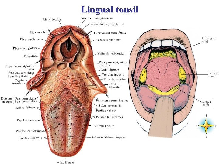 Lingual tonsil 