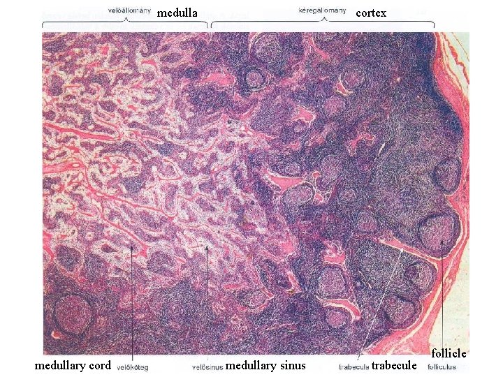 medullary cord cortex medullary sinus trabecule follicle 