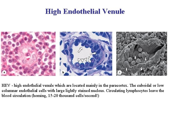 High Endothelial Venule HEV - high endothelial venule which are located mainly in the