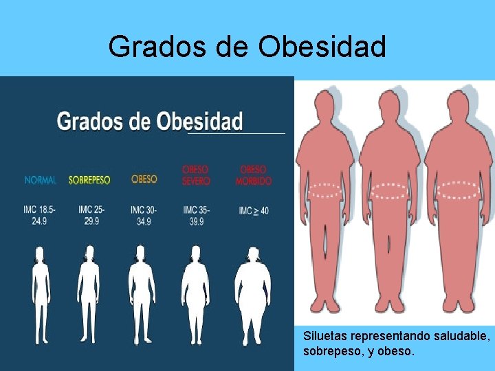 Grados de Obesidad • Siluetas representando saludable, sobrepeso, y obeso. 