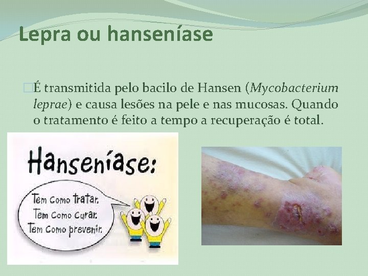 Lepra ou hanseníase �É transmitida pelo bacilo de Hansen (Mycobacterium leprae) e causa lesões