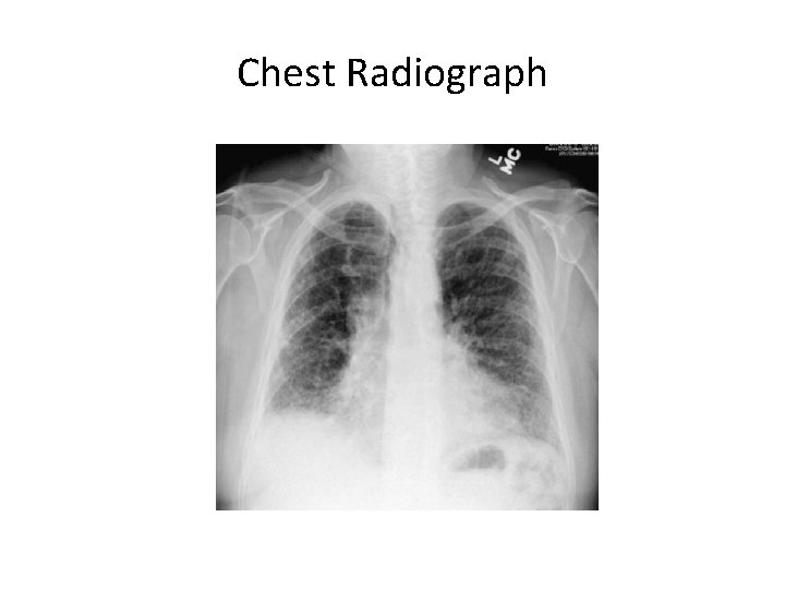 Chest Radiograph 
