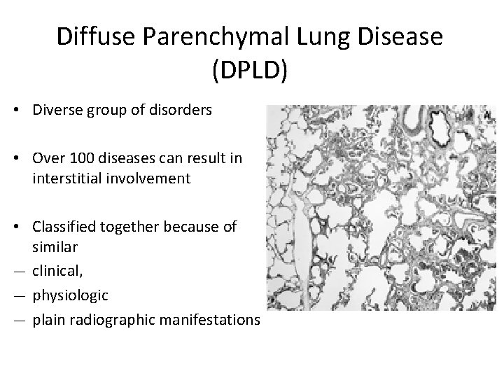 Diffuse Parenchymal Lung Disease (DPLD) • Diverse group of disorders • Over 100 diseases