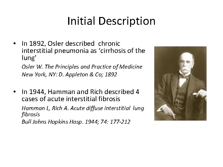 Initial Description • In 1892, Osler described chronic interstitial pneumonia as ‘cirrhosis of the
