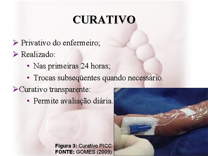 CURATIVO Ø Privativo do enfermeiro; Ø Realizado: • Nas primeiras 24 horas; • Trocas