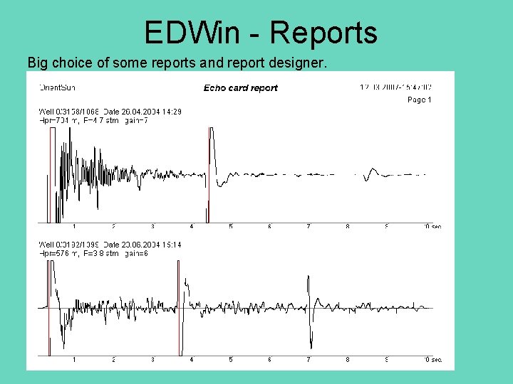 EDWin - Reports Big choice of some reports and report designer. 