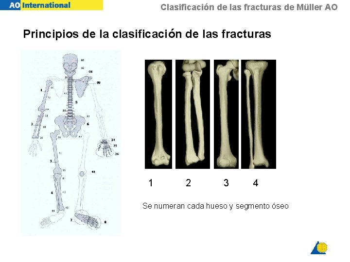 Clasificación de las fracturas de Müller AO Principios de la clasificación de las fracturas