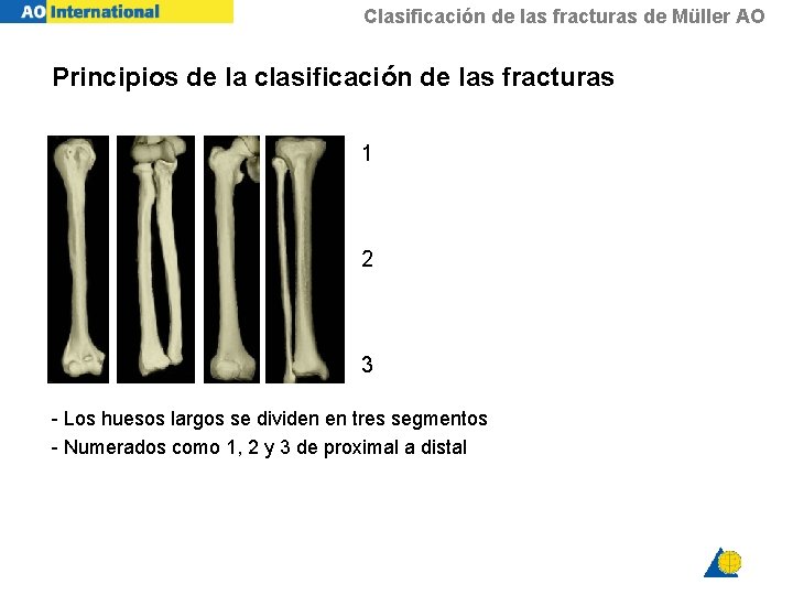 Clasificación de las fracturas de Müller AO Principios de la clasificación de las fracturas
