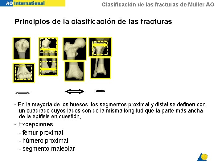Clasificación de las fracturas de Müller AO Principios de la clasificación de las fracturas