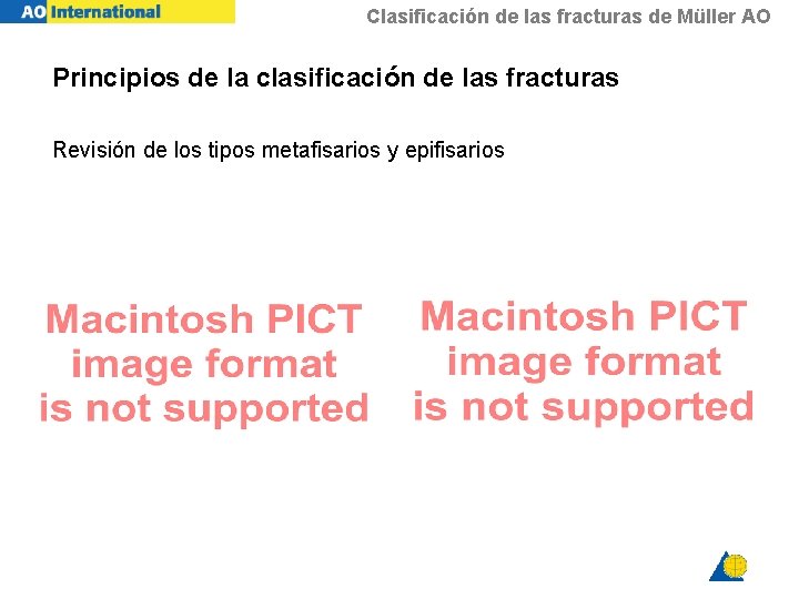 Clasificación de las fracturas de Müller AO Principios de la clasificación de las fracturas