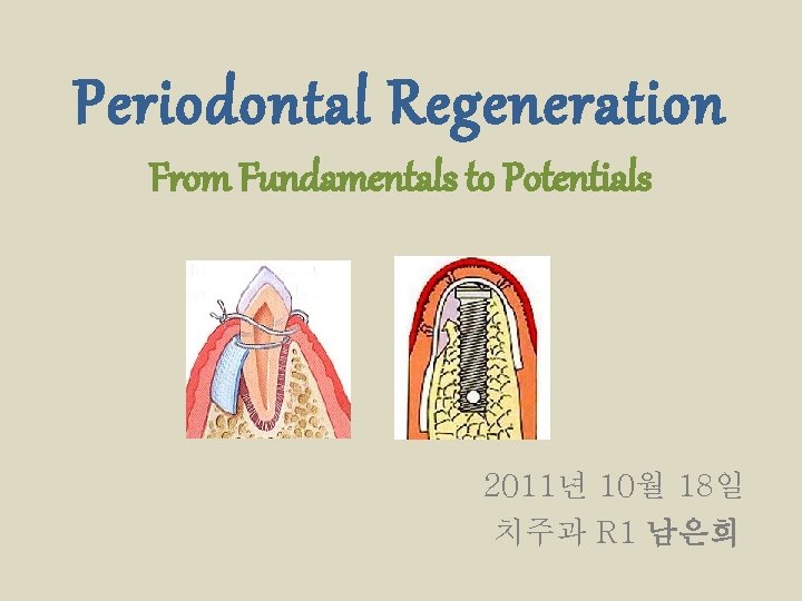 Periodontal Regeneration From Fundamentals to Potentials 2011년 10월 18일 치주과 R 1 남은희 