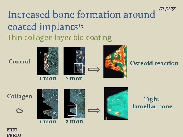 Increased bone formation around coated implants 15 In pigs Thin collagen layer bio-coating Control