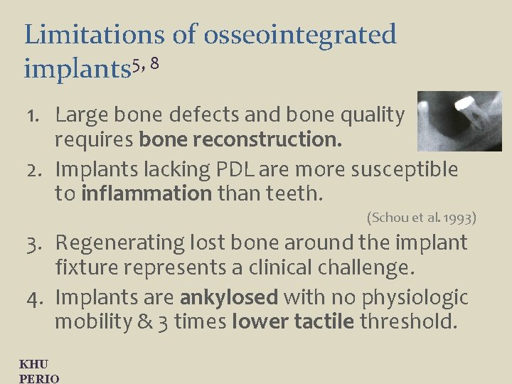 Limitations of osseointegrated implants 5, 8 1. Large bone defects and bone quality requires