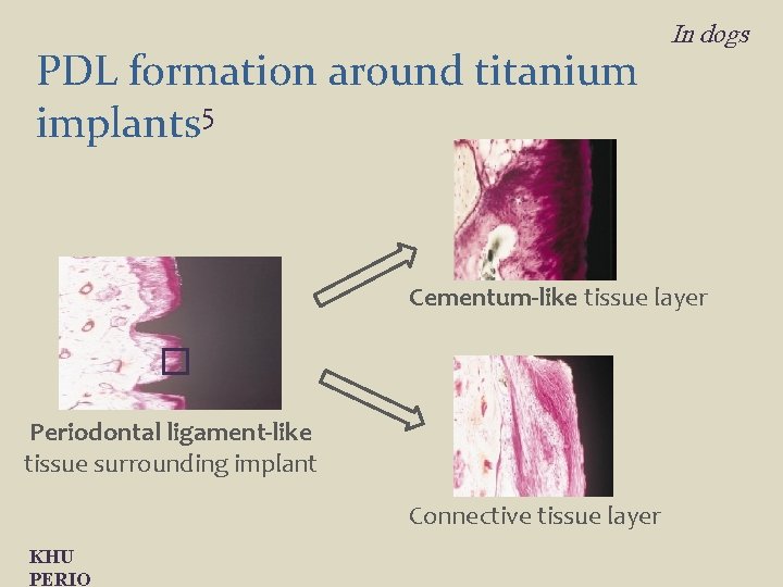 PDL formation around titanium implants 5 In dogs Cementum-like tissue layer Periodontal ligament-like tissue