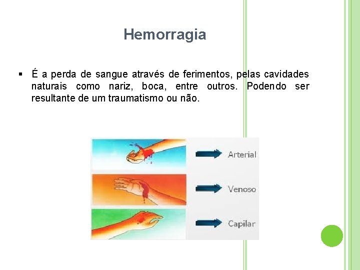 Hemorragia É a perda de sangue através de ferimentos, pelas cavidades naturais como nariz,