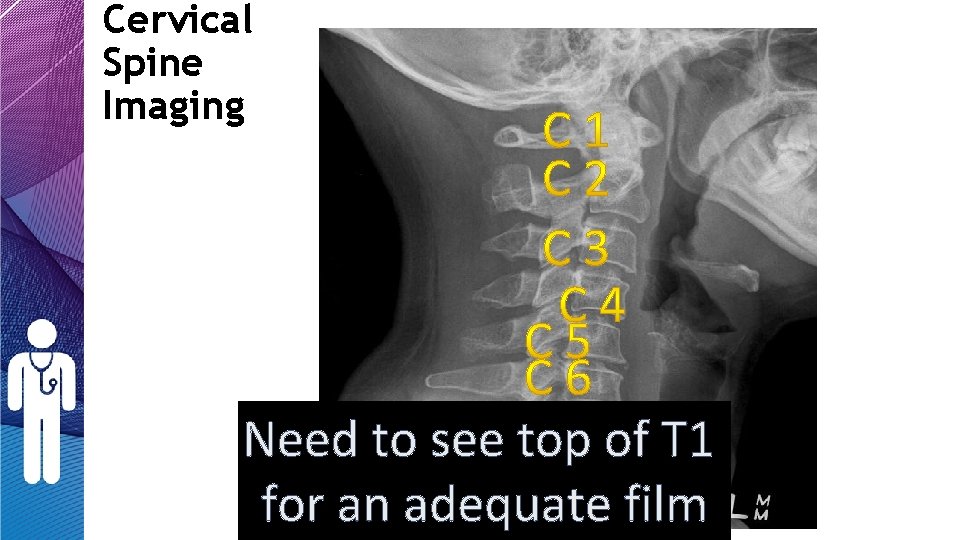 Cervical Spine Imaging Need to see top of T 1 for an adequate film Cervical Spine Imaging Need to see top of T 1 for an adequate film
