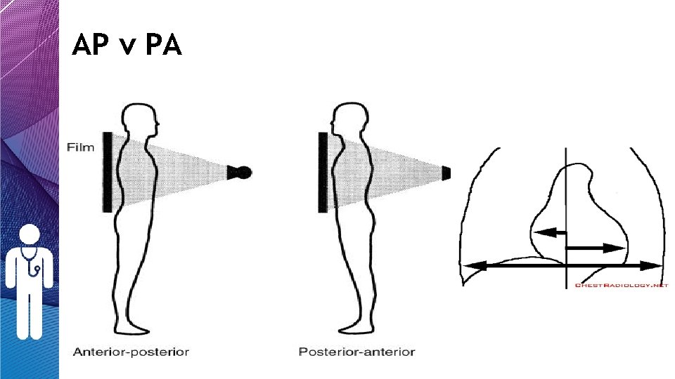 AP v PA AP v PA