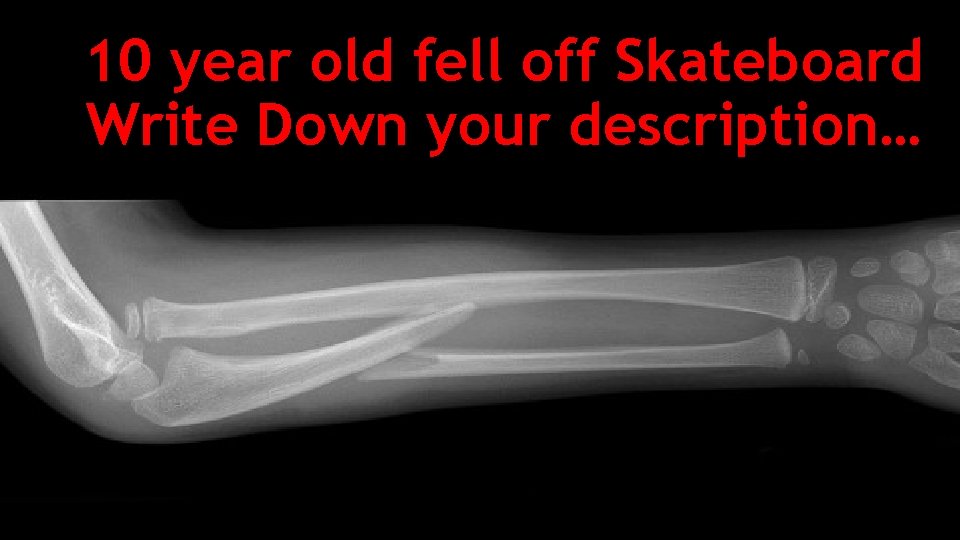 10 year old fell off Skateboard Write Down your description… 10 year old fell off Skateboard Write Down your description…