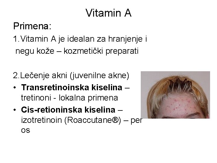 Vitamin A Primena: 1. Vitamin A je idealan za hranjenje i negu kože –