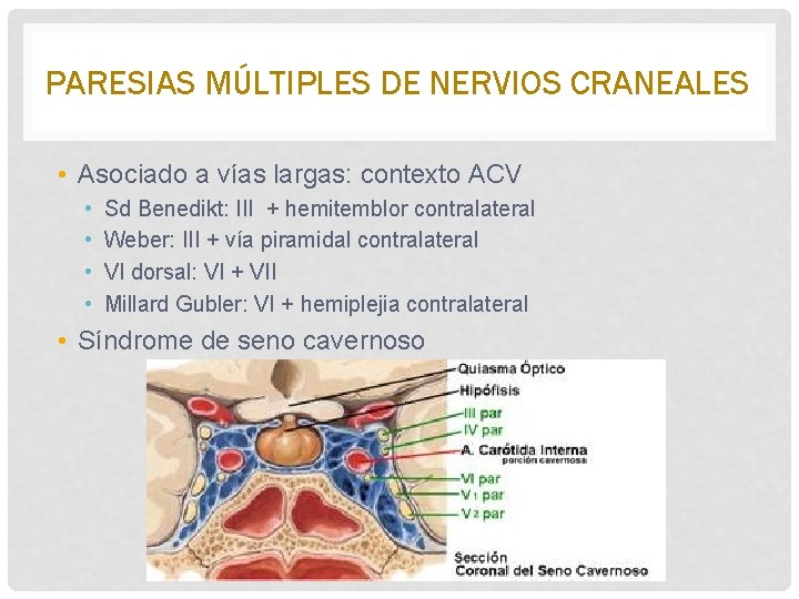 PARESIAS MÚLTIPLES DE NERVIOS CRANEALES • Asociado a vías largas: contexto ACV • •