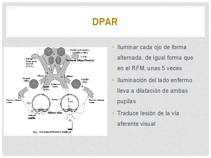 DPAR • Iluminar cada ojo de forma alternada, de igual forma que en el