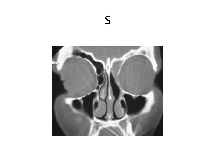 S S