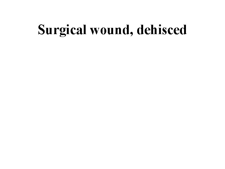 Surgical wound, dehisced 