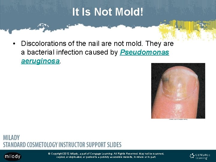 It Is Not Mold! • Discolorations of the nail are not mold. They are