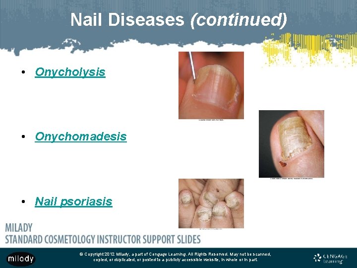 Nail Diseases (continued) • Onycholysis • Onychomadesis • Nail psoriasis © Copyright 2012 Milady,