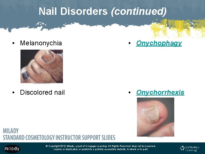 Nail Disorders (continued) • Melanonychia • Onychophagy • Discolored nail • Onychorrhexis © Copyright