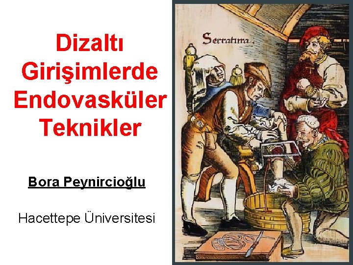 Dizaltı Girişimlerde Endovasküler Teknikler Bora Peynircioğlu Hacettepe Üniversitesi 