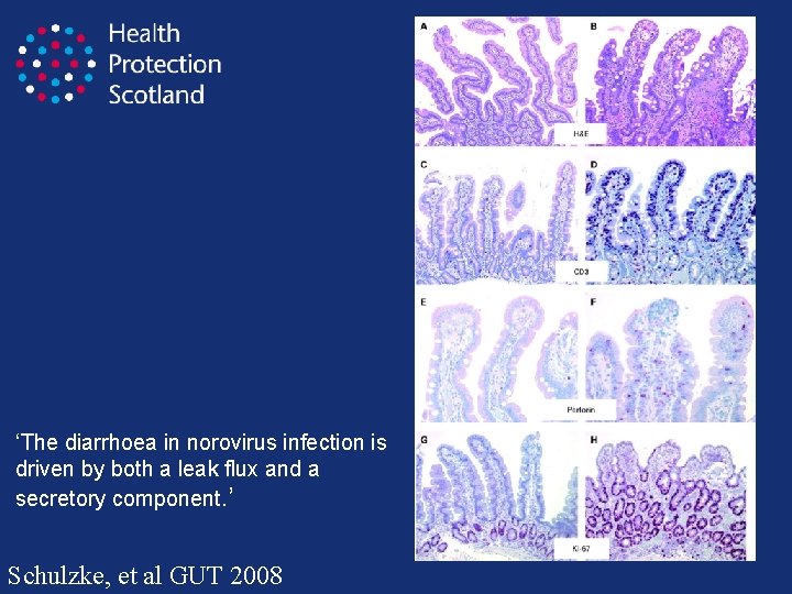 ‘The diarrhoea in norovirus infection is driven by both a leak flux and a