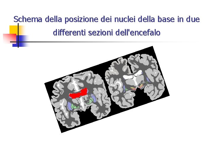 Schema della posizione dei nuclei della base in due differenti sezioni dell'encefalo 